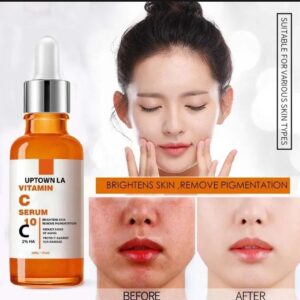Skin Brightening Vitamin C Serum – Anti-Acne & Blemish Removal (Liquid Formula)